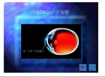 lasik5