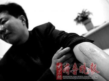 38岁女子为爱情要手术变成男性图