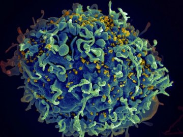 HIV毒性进化中日渐减弱 或变成无害疾病？