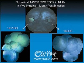 中美联手攻关非典疫苗 猴子治疗双眼发绿光