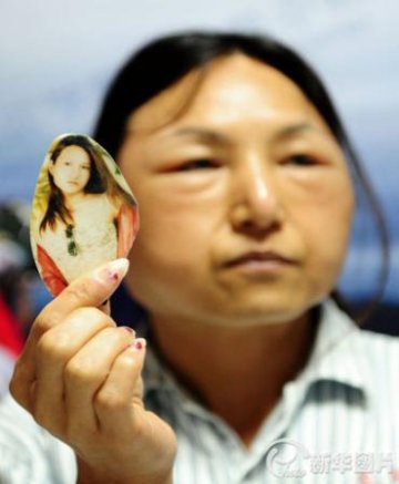 妙龄女注射丰脸针变“老太婆” 曾几度寻死