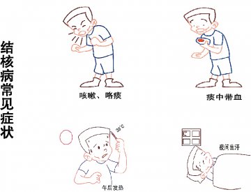 肺结核常见知识问答