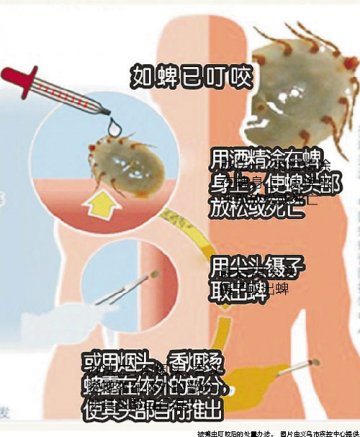 菜地干活后高烧不退 八旬翁被蜱虫叮咬致死