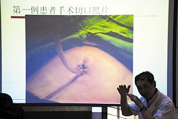 少女原是男儿身 肚脐动刀变了性