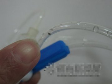 输液管里有异物患者受惊吓