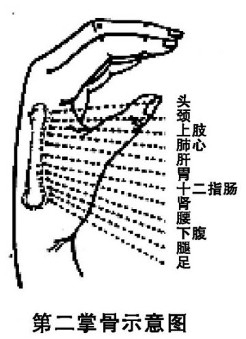 针灸止疼立竿见影