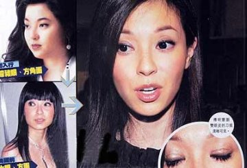 香港女星整容机密档案