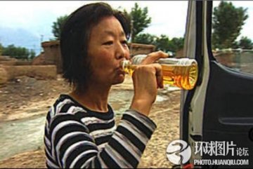大庆农妇患奇特异食癖