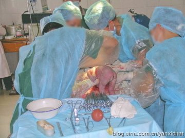 女性很伟大！惊心动魄剖腹产全程