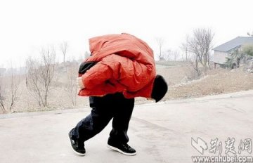 男子得罕见怪病弯成“虾公”
