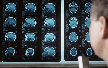美再谋划时代突破：斥巨资绘人脑活动图