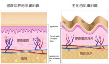 爱尔丽法拉丽提拉术 缔造逆龄回春奇迹