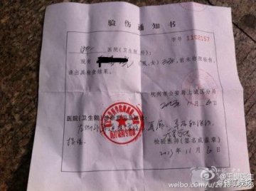 浙二医院一医生被病患殴打致耳膜撕裂