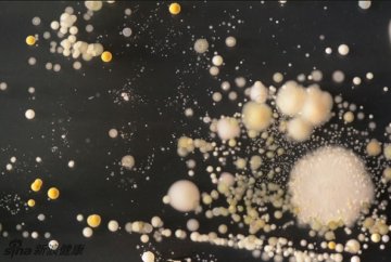手机上的细菌其中大部分是无害的