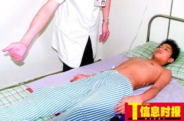 少年半夜梦游爬3楼失足摔骨折图