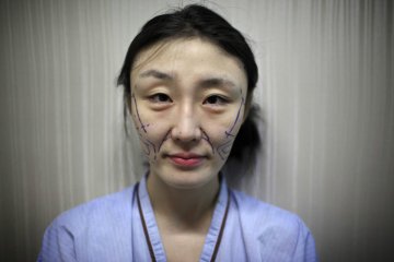 韩国摄影师记录5位模特血腥整容蜕变全程