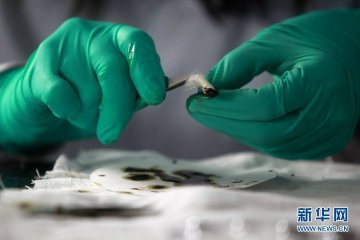 目击胶囊检测全过程