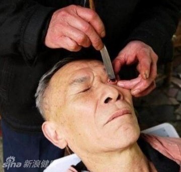 4.师傅在给顾客洗眼，顾客躺着一动不动