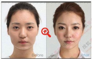 31个惊人韩国整容案例