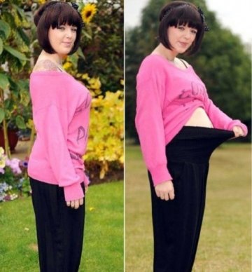 英女子患怪病一进食肚皮就如气球似怀孕
