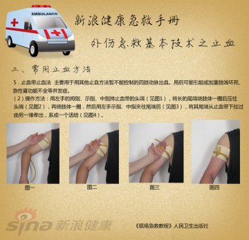 止血带止血法操作方法