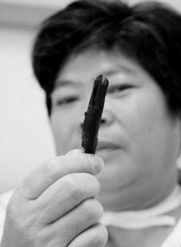 全球最怪异人体：肺里能长树