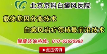 工厂濒临倒闭 压力过大急出白癜风