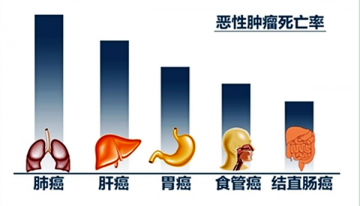 癌症，究竟死于什么？