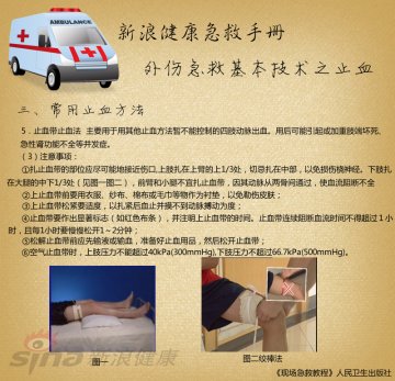 止血带止血法注意事项