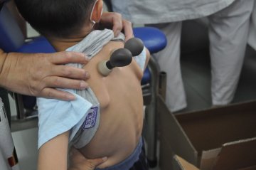 儿童敷三伏贴