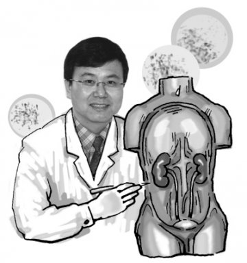 肾结石 根据大小选择疗法