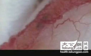 神奇的生命：实拍女性排卵真实过程