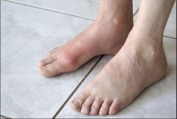 从脚看你的身体是否健康