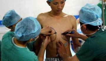 揭开变性手术神秘面纱 实拍男人变女人震撼全程