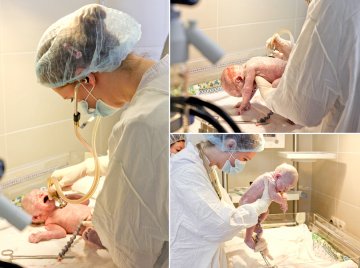 高清：直击年轻母亲剖腹产分娩全过程