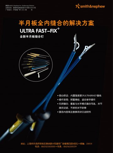 半月板缝合钉-Ultra FAST-FIX(国食药监械(进)字2010第3650612号)精美广告图欣赏