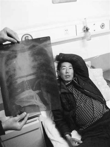 国家级贫困县尘肺病之痛：村民开始大规模发病